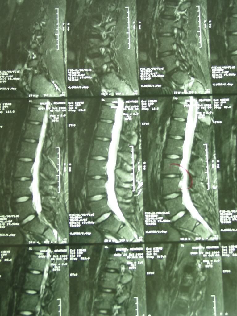 spinal cross-section Pictures, Images and Photos