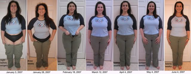 beforeafterhires.jpg picture by findingjill