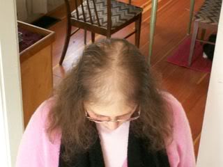 Meowser's bald spot
