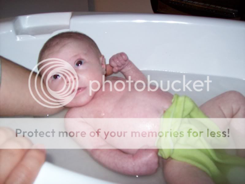 Mottling Skin... anyones baby have this??? JustMommies Message Boards